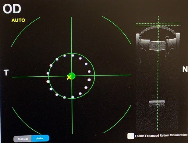 Model Eye - Standard with Spherical Cornea